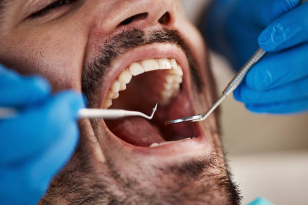Best Emergency Treatment for Oral Infections in Los Alamos, CA