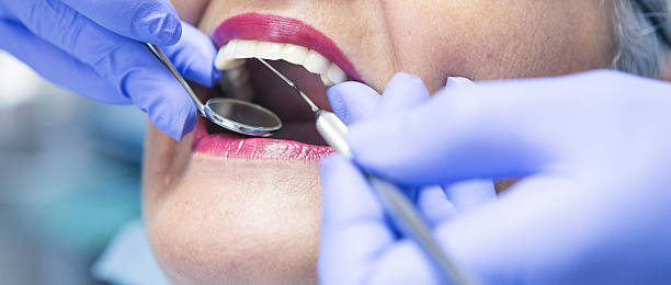 Best Emergency Wisdom Tooth Extraction in Los Alamos, CA